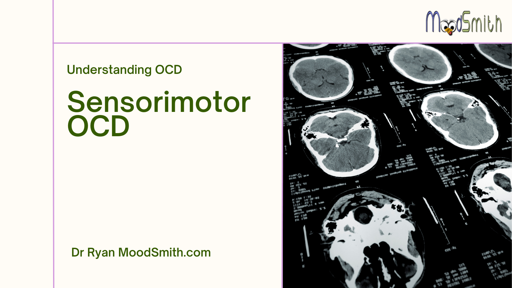 image of brain with words 'understanding sensorimotor OCD and MoodSmith logo